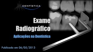 Exame Radiográfico  Aplicações em Dentística [upl. by Auberbach188]