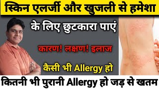 Sarir me khujli hone ke karan स्किन ऐलर्जी का इलाज khujli ka ilaj  Skin Allergy Treatment At Home [upl. by Alrzc]