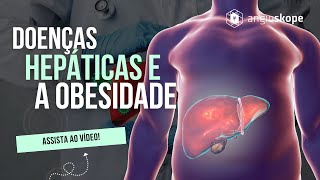 Doenças hepáticas e a obesidade  Parte 1  Clínica Angioskope [upl. by Dorina]