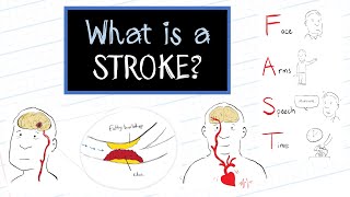 What is a Stroke HealthSketch [upl. by Michel787]