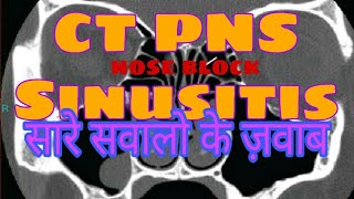 CT Scan PNS Sinusitis in Hindi  by Radiographer Guruji [upl. by Oalsinatse]