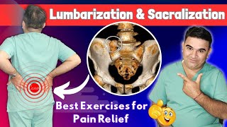 Unlocking Low Back Pain Relief Lumbrization of S1 amp Sacrilization of L5 Explained [upl. by Lorimer]