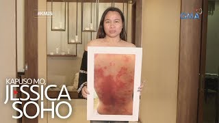 Kapuso Mo Jessica Soho Ilang kababaihan nabiktima diumano ng pekeng beauty products [upl. by Susanna456]