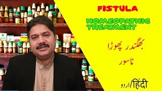 Fistula Homeopathic Treatment [upl. by Skoorb73]