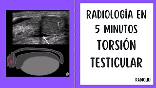 Radiología en 5 minutos Torsión Testicular [upl. by Gromme]