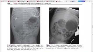 EMERGENCY RADIOLOGY REQUISITES [upl. by Phelps295]