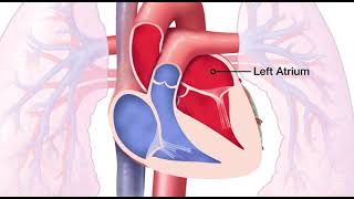 Mitral Valve Regurgitation [upl. by Meldoh]