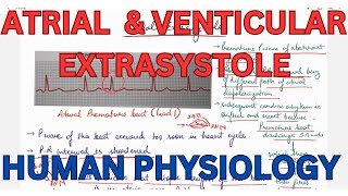 ATRIAL extrasystole Ventricular Extrasystole compensatory pause CVS [upl. by Hsakiv]