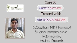 Case of Guttate Psoriasis II Homeopathy treatment II Dr Gowtham [upl. by Adnara]