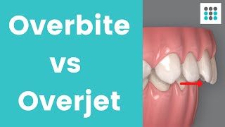 OVERBITE VS OVERJET l Dr Melissa Bailey Orthodontist [upl. by Akiram]