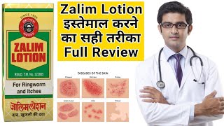 Zalim lotion fungal treatment  Zalim lotion for fungal infection  Zalim Lotion Use in Hindi [upl. by Sina]