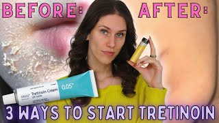 3 Ways To Start Tretinoin Without Irritation  How To Start Retinoids Without Irritation amp Peeling [upl. by Aleira]