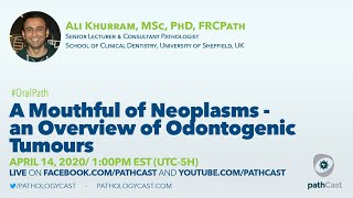 A Mouthful of Neoplasms  an Overview of Odontogenic Tumours  Dr Khurram ORALPATH [upl. by Ojadnama]