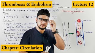 Thrombosis amp Embolism Cardiovascular Disorder  Chapter circulation  Video  12 [upl. by Darwin]