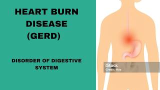 Acid reflux  Heart burn GERD  Disorder of Digestive system [upl. by Hterag]