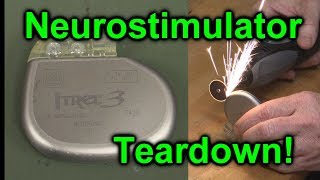 EEVblog 1027  Implantable NeuroStimulator Teardown [upl. by Naliorf]