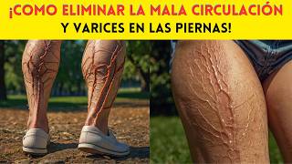 Como Eliminar la Mala Circulación y Varices en las Piernas [upl. by Magnien999]