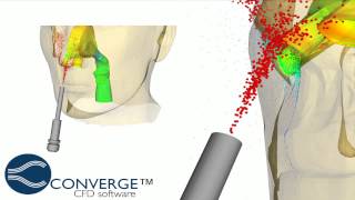 Simulation of Nasal Drug Delivery Systems in CONVERGE 12 [upl. by Aierbma901]