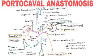 PORTOCAVAL ANASTOMOSIS  PORTOSYSTEMIC COMMUNICATIONS [upl. by Latty]