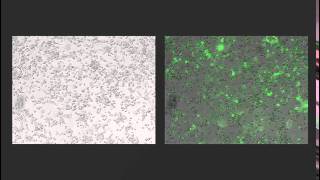 JuLI Stage Application Video Osteoclast cell monitoring with timelapse image for 3 hours [upl. by Scribner]