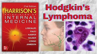 HODGKINS LYMPHOMA  Presentation  Diagnosis  Staging  Treatment  Harrison [upl. by Coe]