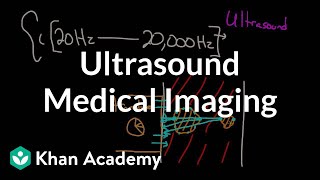 Ultrasound medical imaging  Mechanical waves and sound  Physics  Khan Academy [upl. by Neelia]