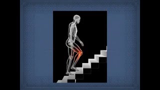 Knee Pain Complex Causes of Patellofemoral Syndromekneeosteoarthritiskineticinjurychain [upl. by Accemahs]