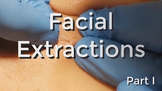 Facial Extractions  Part I [upl. by Annairdua]