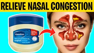 8 Ways To Naturally Relieve Nasal Congestion [upl. by Dash]