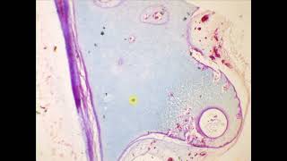 Hyaline cartilage Hyaline cartilage Special stain [upl. by Dobb207]