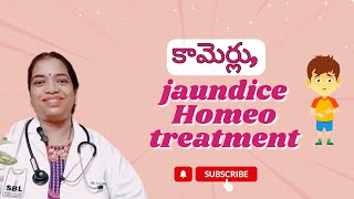 కామెర్లు jaundiceHomeo treatment SudharamanHomeoClinic [upl. by Atiker]