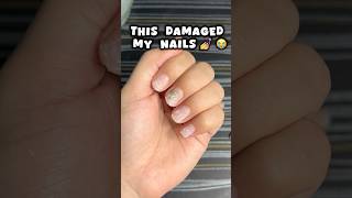 Nail extensions ki galti 😭😭nails nailsextension viralvideo shortsfeed viralshort trending [upl. by Ennovaj13]