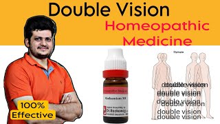 Diplopia  Homeopathic medicine for Double Vision  How to use  100 Effective [upl. by Oab]