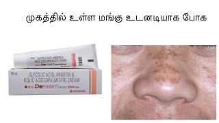 Demelan cream Review in Tamil  Mangu முகத்தில் உள்ள மங்கு உடனடியாக போக [upl. by Feil]