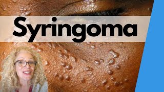 DISCOVER THE HIDDEN SOLUTION TO SYRINGOMA  Best treatments revealed [upl. by Dilisio]