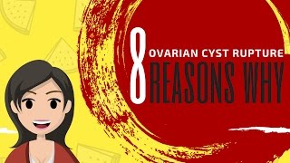 Ovarian Cyst Quick Symptoms List [upl. by Aliam]