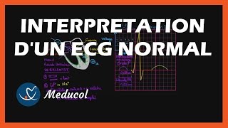 Electrocardiogramme ECG  interpretation dun ECG normal [upl. by Drummond]