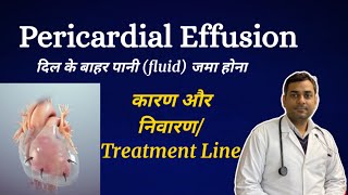 Pericardial effusion in hindi detail  pericardial effusion treatment line [upl. by Samson227]