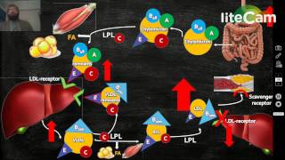 Familial Hypercholesterolemia [upl. by Euqinotna]