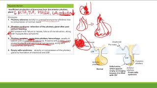 Hypopituitarism  Endocrine System  Step 1 Simplified [upl. by Morrell124]