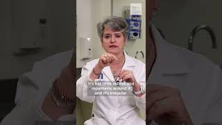 Learn about the ABCDE symptoms of melanoma with Dr Ida Orange melanoma skincancer [upl. by Aime]