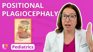 Positional Plagiocephaly Musculoskeletal Disorders  Pediatric Nursing  LevelUpRN [upl. by Tatiana]