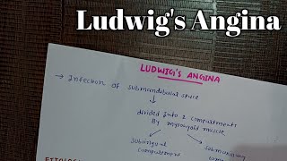 LUDWIGS ANGINA  ENT [upl. by Ytinav589]