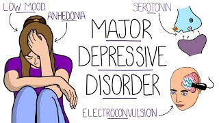 Depression Explained Major Depressive Disorder [upl. by Newton594]