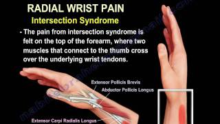 Wrist Paincauses and treatmentPart 2  Everything You Need To Know  Dr Nabil Ebraheim [upl. by Kcirdled]