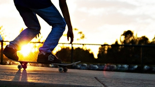 Skateboarding Nosebleed [upl. by Chassin206]