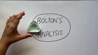 quotBoltons Analysis in Orthodontics A Comprehensive Overviewquot [upl. by Komsa]