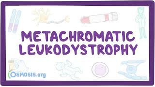 Metachromatic leukodystrophy  causes symptoms diagnosis treatment pathology [upl. by Enelym]