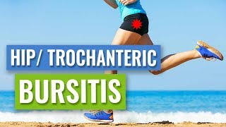 Lateral Hip or Trochanteric Bursitis  Causes and Treatment [upl. by Aihsyla]