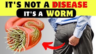 9 Major Signs of Intestinal Parasites and Their Solutions [upl. by Edgell]